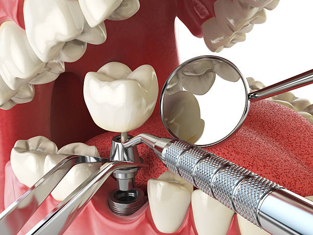 Best Mobile Emergency Dentist in St Marys, GA